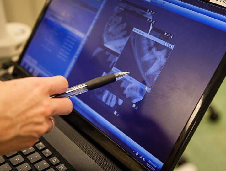 Digital Dental Radiology